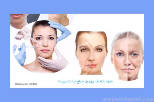 بهترین جراح لیفت صورت تهران هزینه لیفت صورت 4 پزشک پنجه طلا لیفت صورت